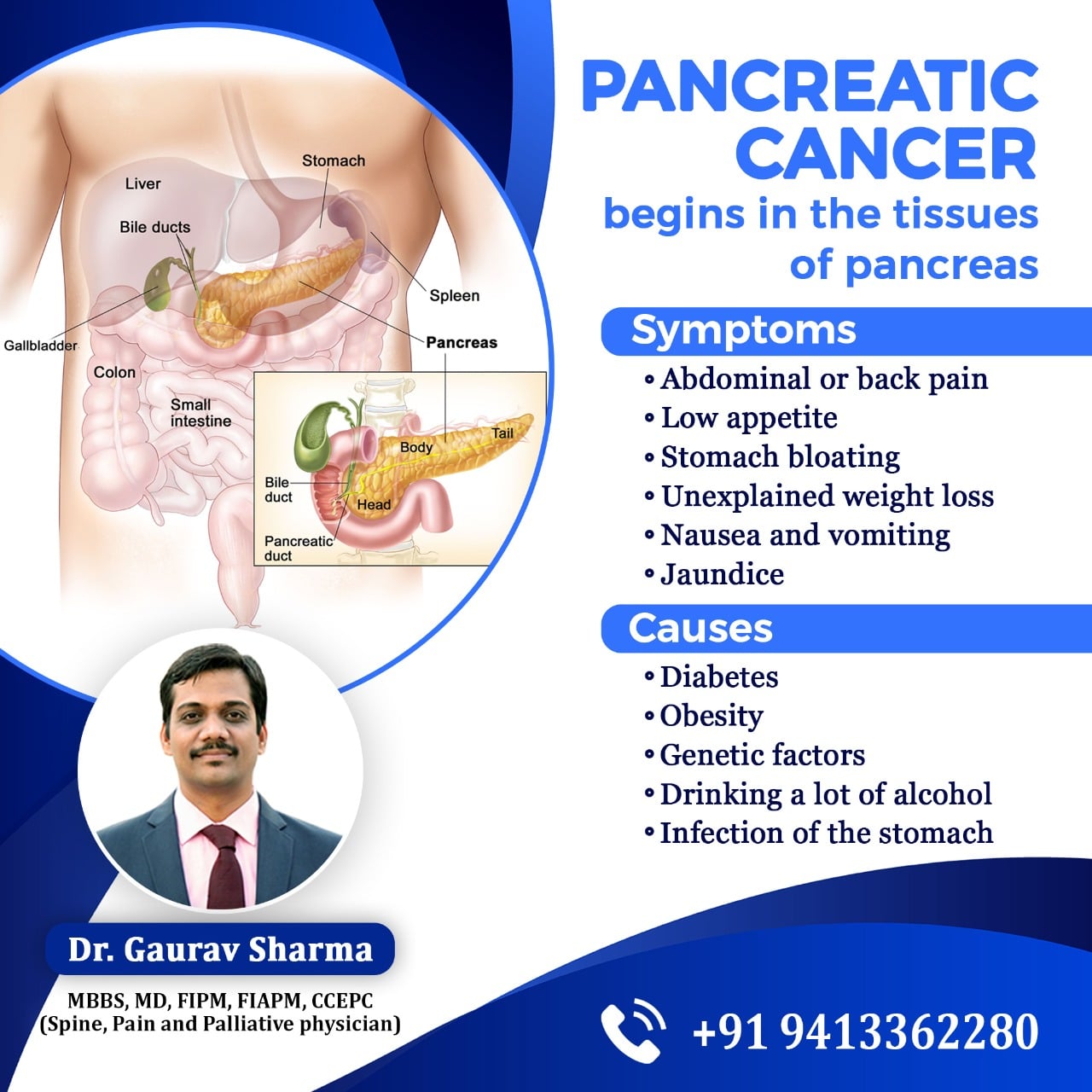 Pancreatic Cancer Symptoms & Causes