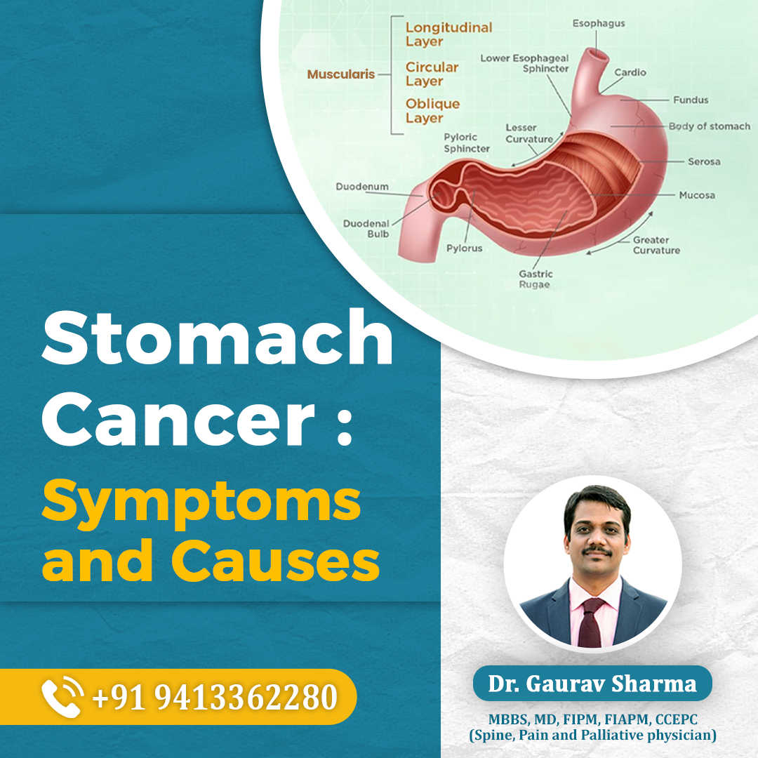 Stomach Cancer Major Causes and Symptoms