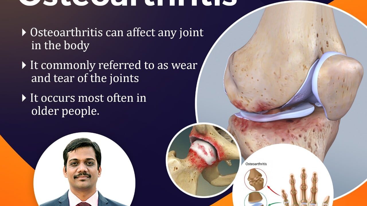 Osteoporosis: Causes and Symptoms