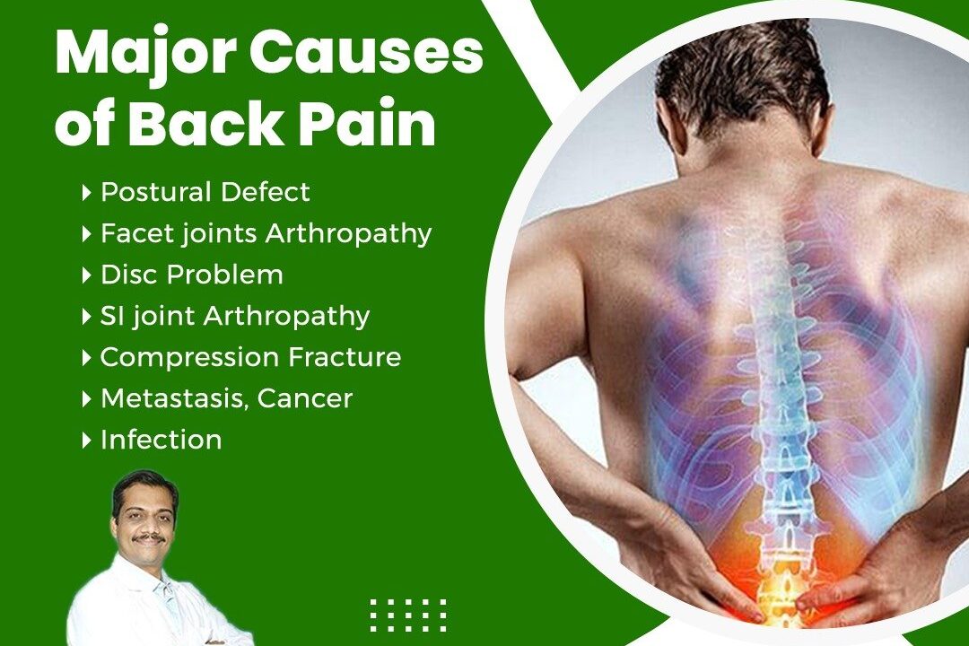 Back Pain & Its Causes