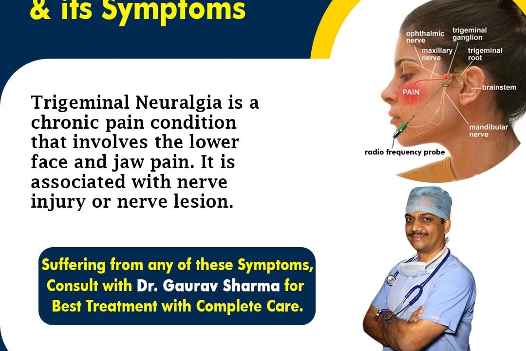 Know About Trigeminal Neuralgia & its Symptoms