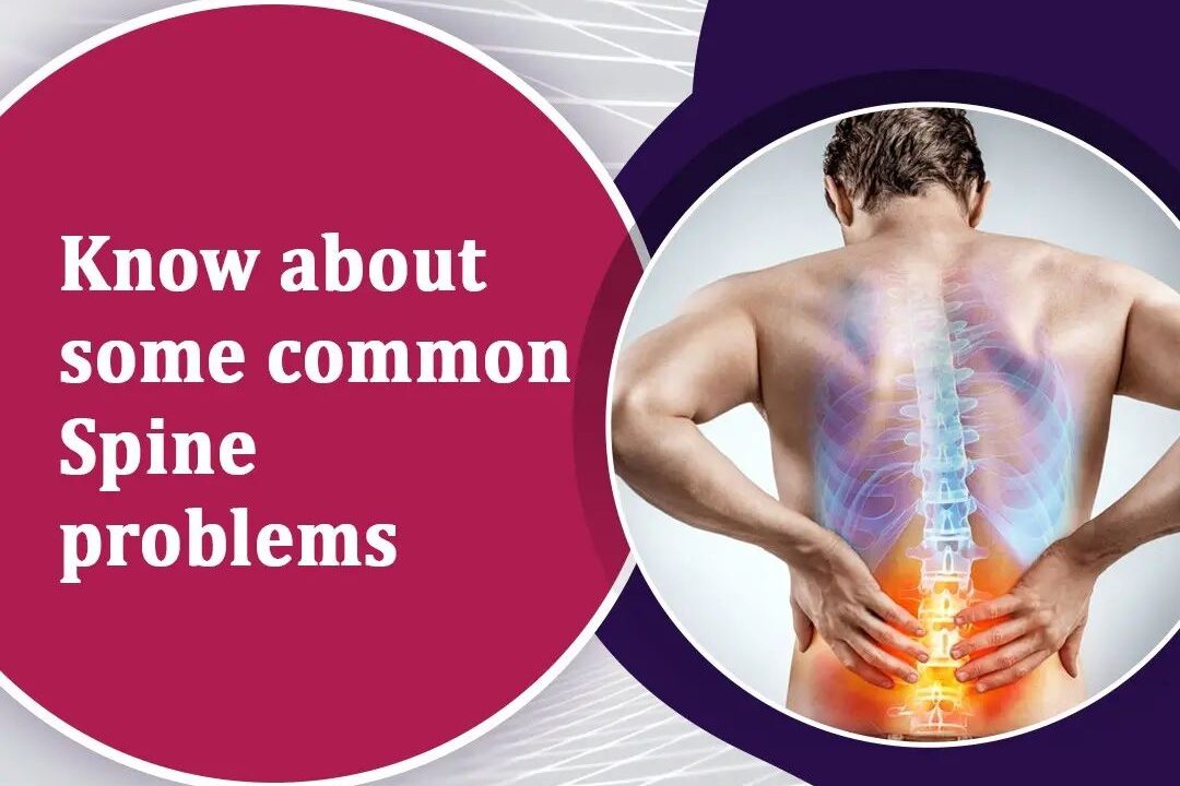 Know about some common Spine problems