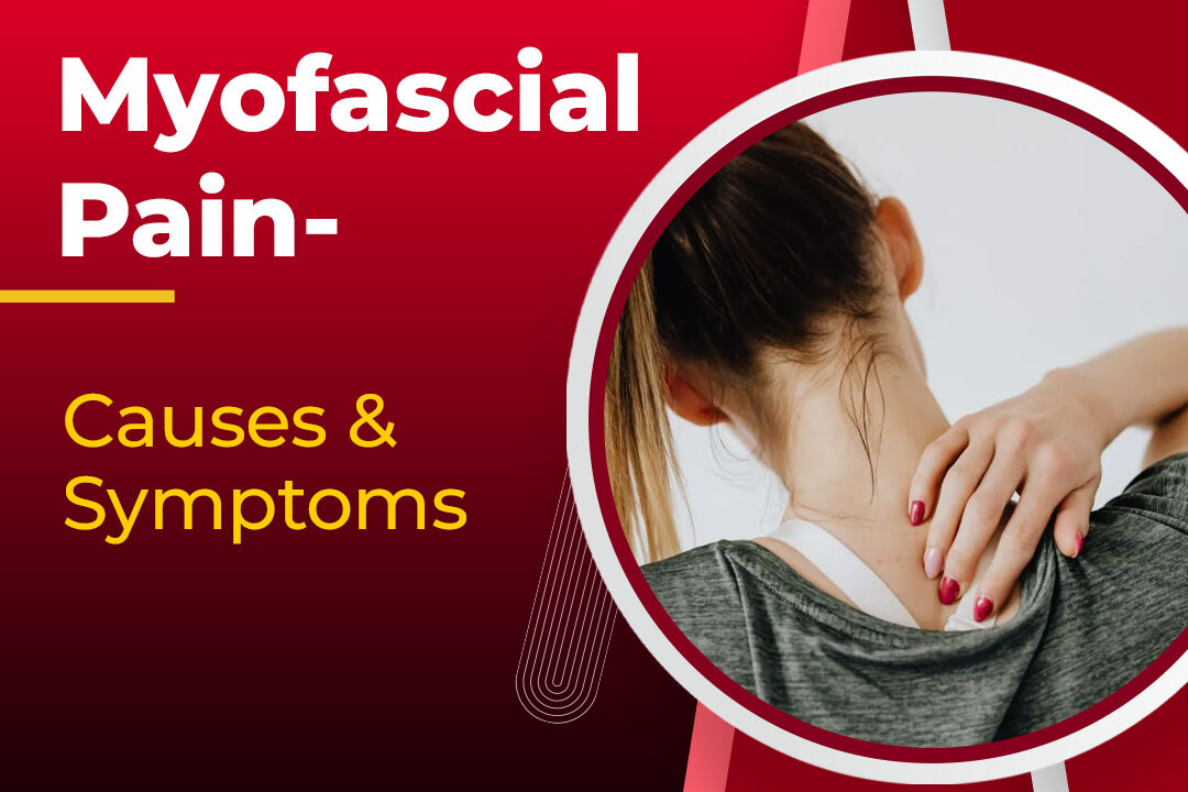 Myofascial Pain- Causes and Symptoms