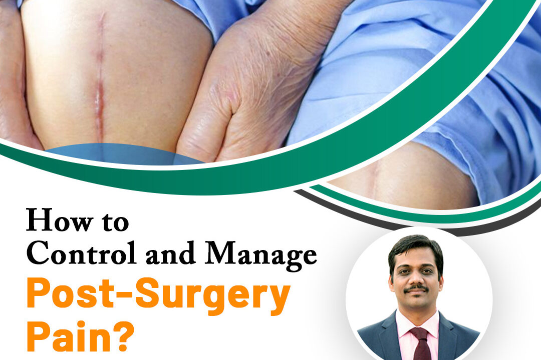 How to Control and Manage Post-Surgery Pain?