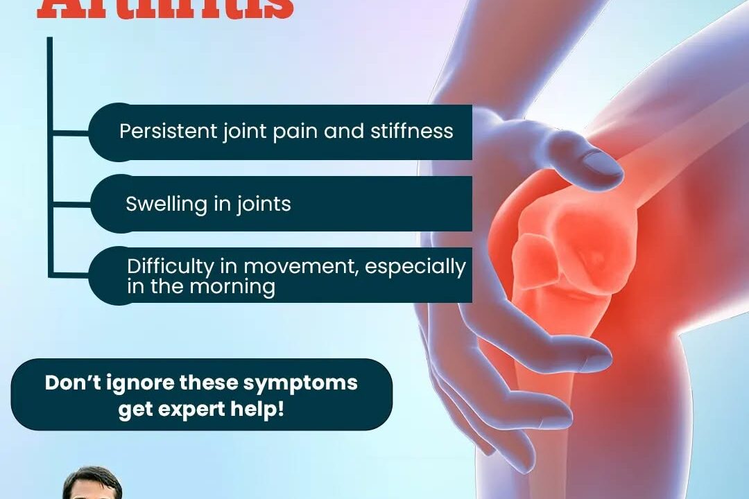 Signs You May Have Arthritis