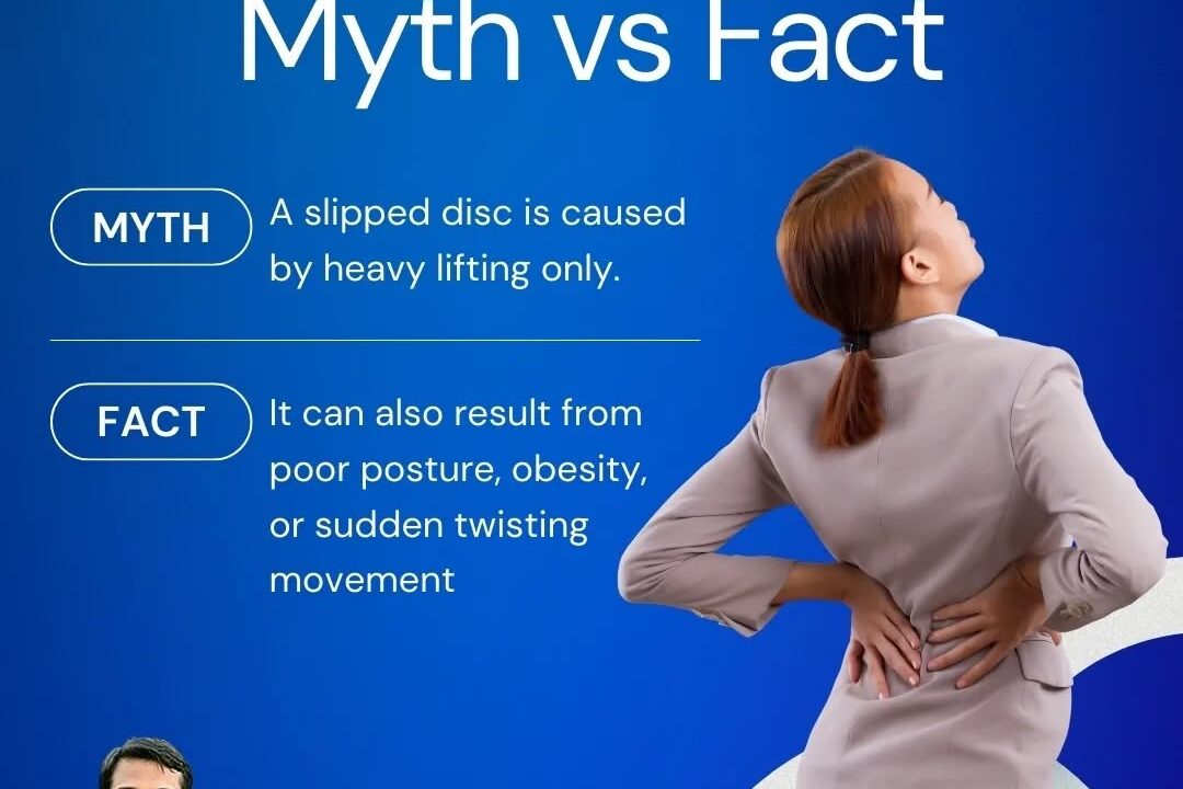 Slipped Disc: Myth V/s Fact